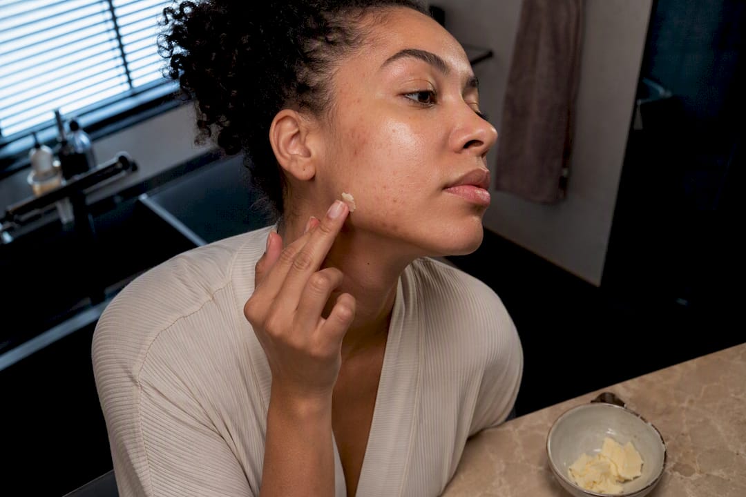 Shea butter applied to blemish-prone jawline