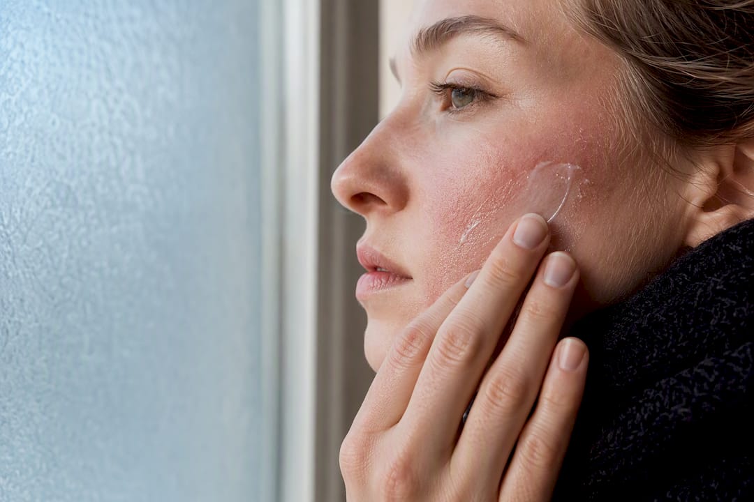 Moisturiser applied to windburned cheek